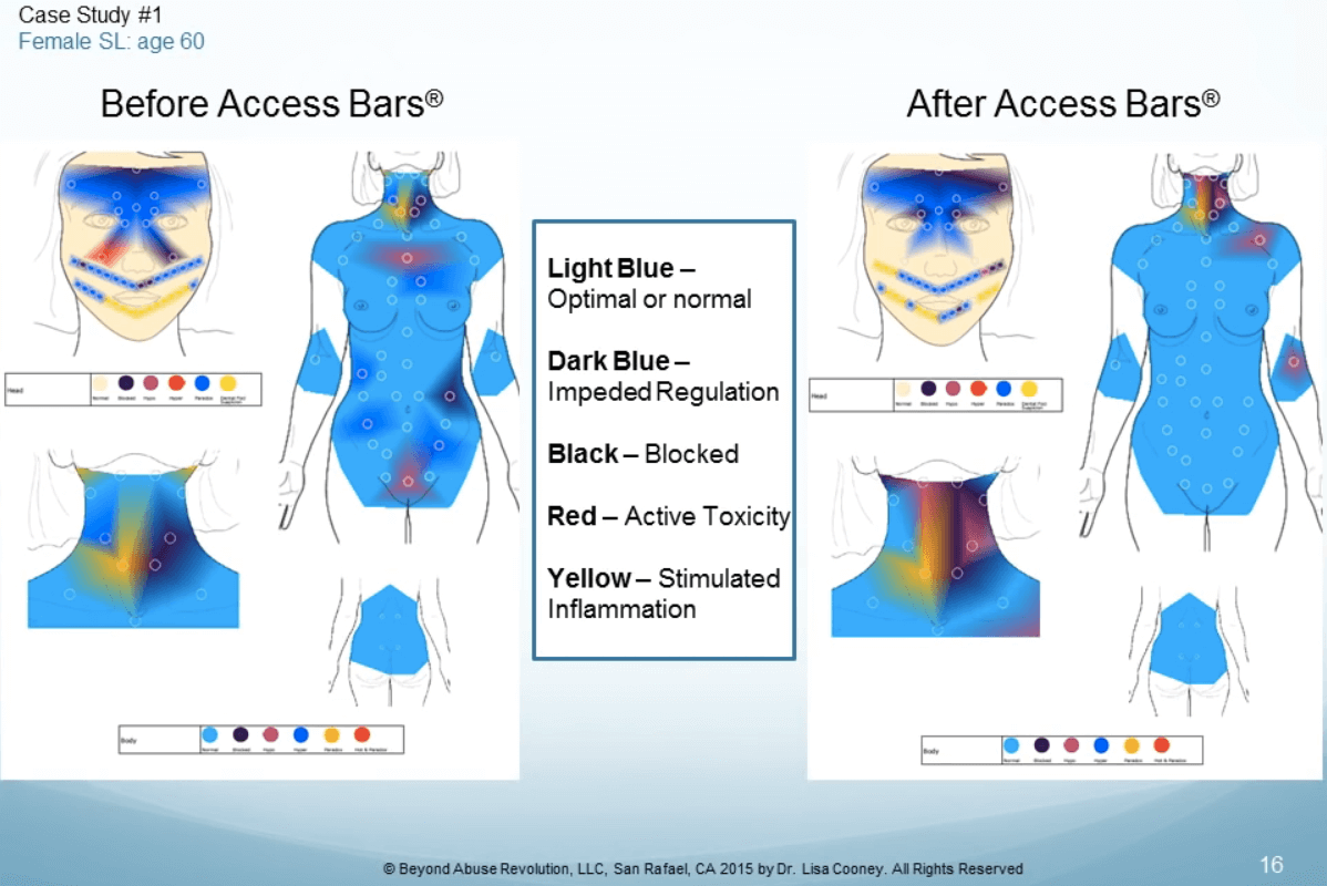 Dr. Cooney study on Access Bars and Thermometry — before and after of case study 1