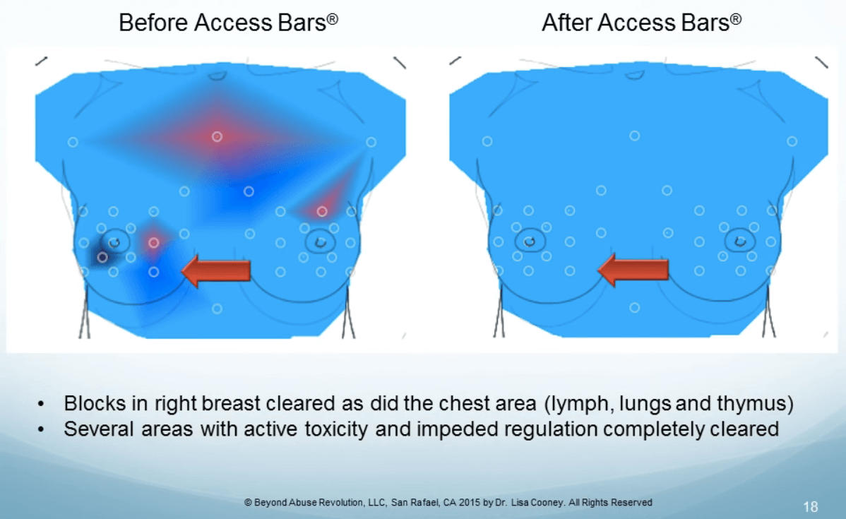 Dr. Cooney study on Access Bars and Thermometry — before and after 2 of case study 1