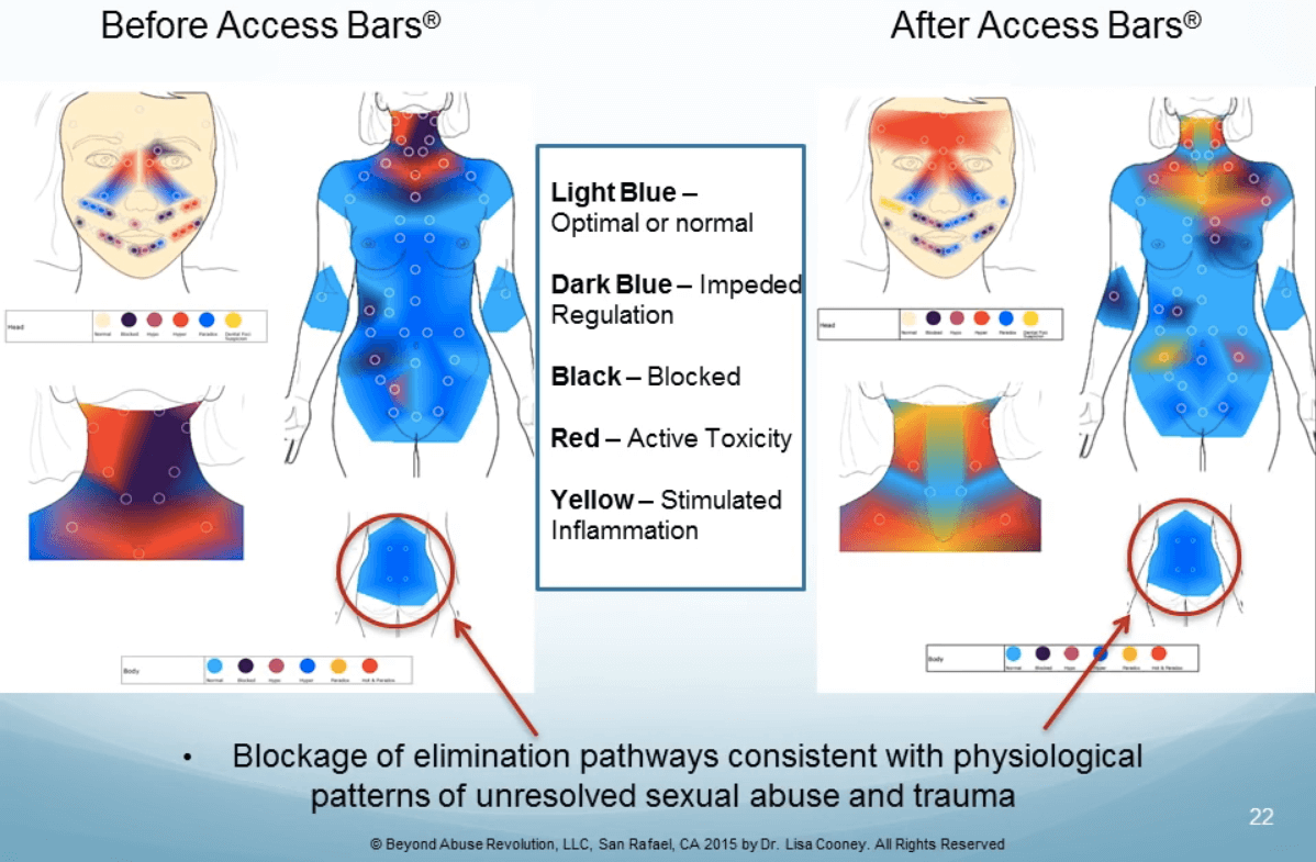 Dr. Cooney study on Access Bars and Thermometry — before and after of case study 2