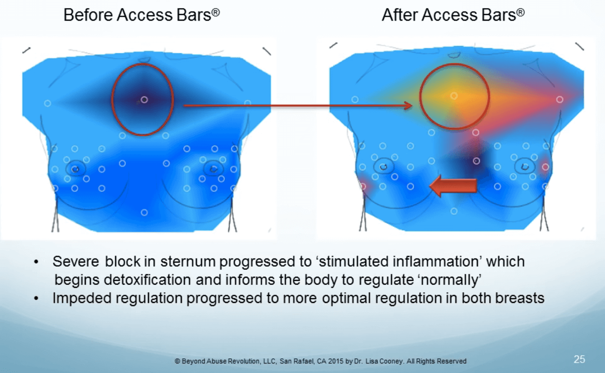 Dr. Cooney study on Access Bars and Thermometry - Case study 2 - before and after 2